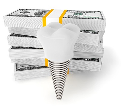 implant next to money illustrating the long-term benefits of implants in Mayfield Heights