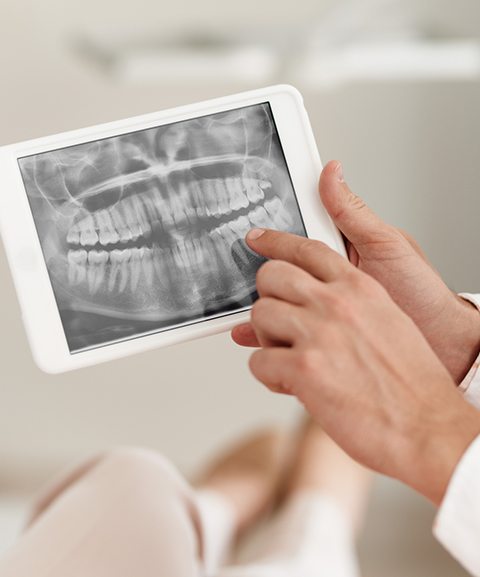 Digital x-rays on tablet computer