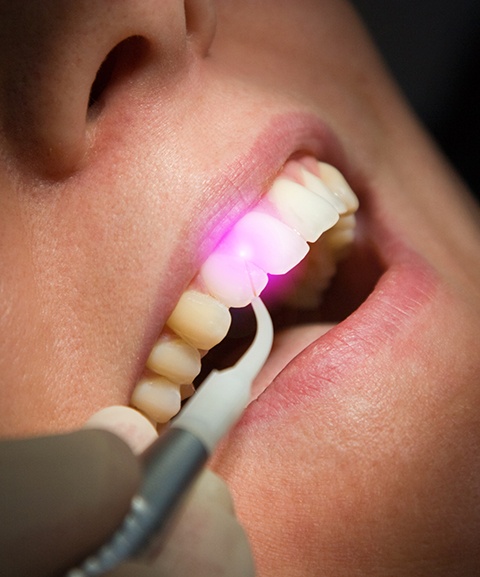 Patient receiving laser periodontal treatment