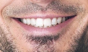 Example of front of mouth smile photo