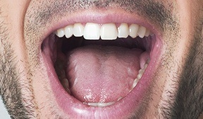 Example of open mouth up smile photo