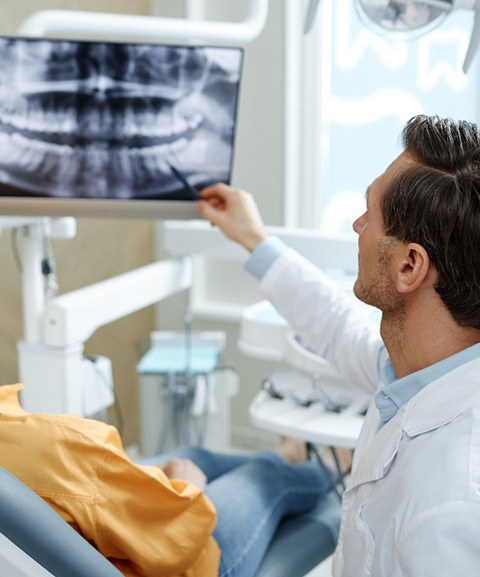 Wisdom tooth X-ray showing impacted molar position 