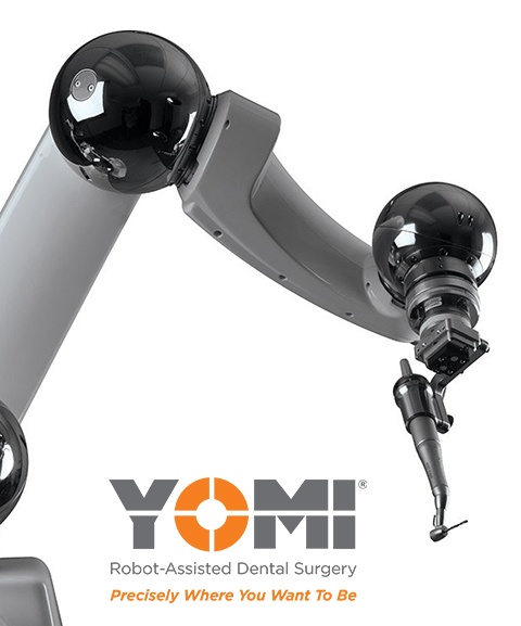 Yomi robot assisted dental implant surgery tool